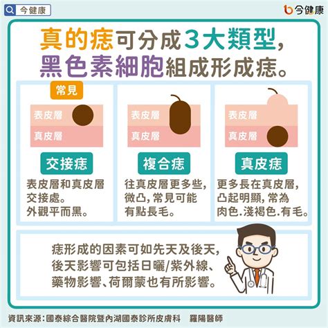 為什麼痣會長毛|是痣？皮膚癌？還是什麼？常見Q&A解惑！醫教揪出「。